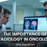 The Importance of Radiology in Oncology