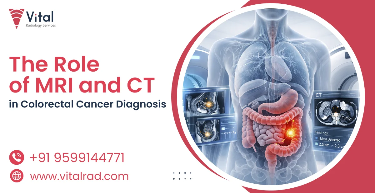 Colorectal Cancer Diagnosis: MRI and CT Role