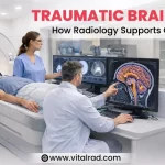 Traumatic Brain Injury: How Radiology Supports Quick Diagnosis