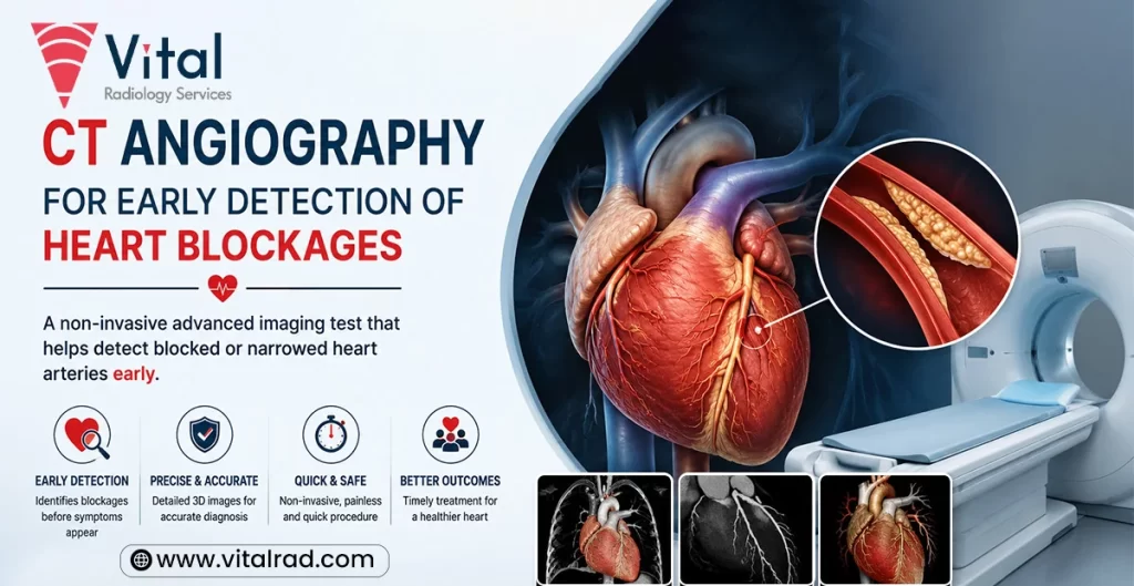 CT Angiography for Early Detection of Heart Blockages