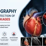 CT Angiography for Early Detection of Heart Blockages