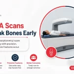 How DEXA Scans Detect Weak Bones Early