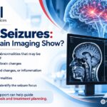 MRI for Seizures