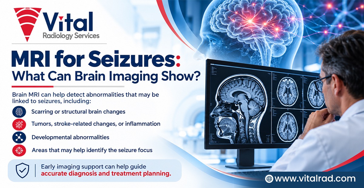 MRI for Seizures